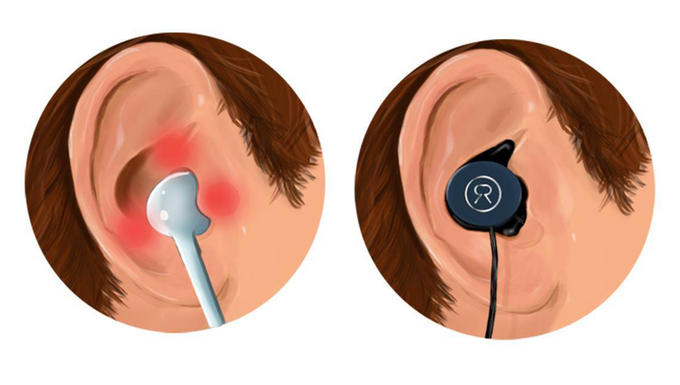 [產品設計]Revols客製化耳型耳機